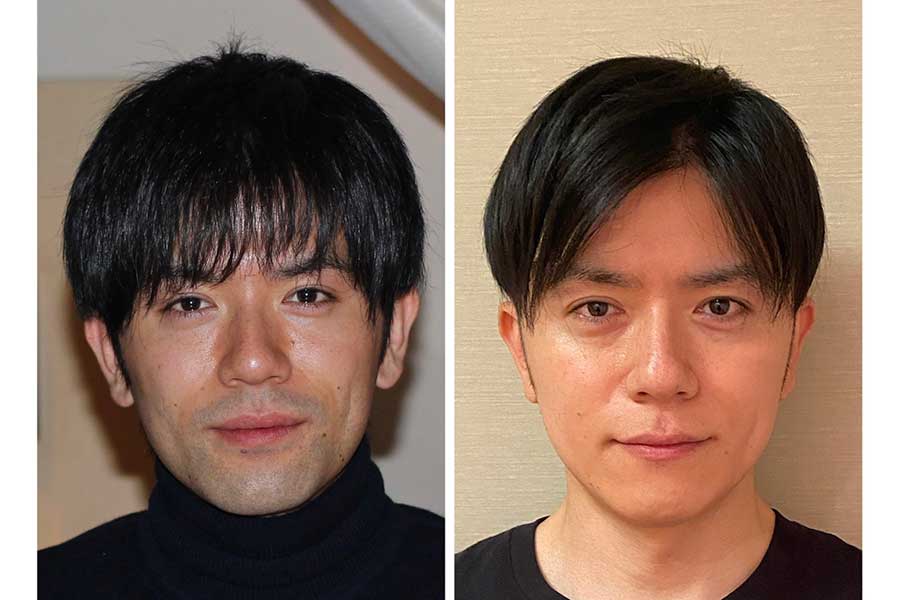青木源太、「同一人物とは思えない写真」を投稿　ヒゲ脱毛の効果に驚き「右の方が30代に見えます」