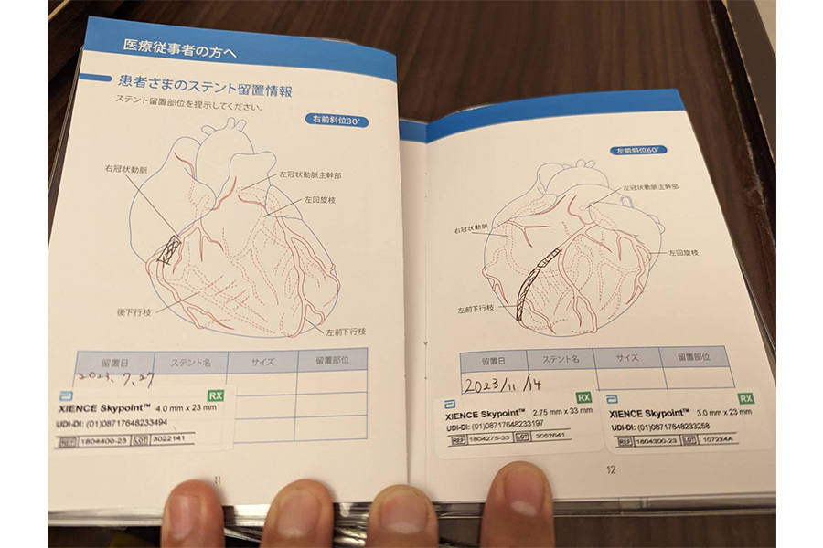 ステントは右に1本、左に2本入っている【写真：和田さん提供】