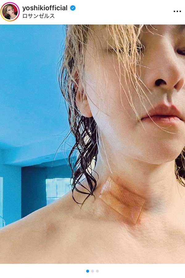 YOSHIKIの実際の投稿【写真：インスタグラム（@yoshikiofficial）より】