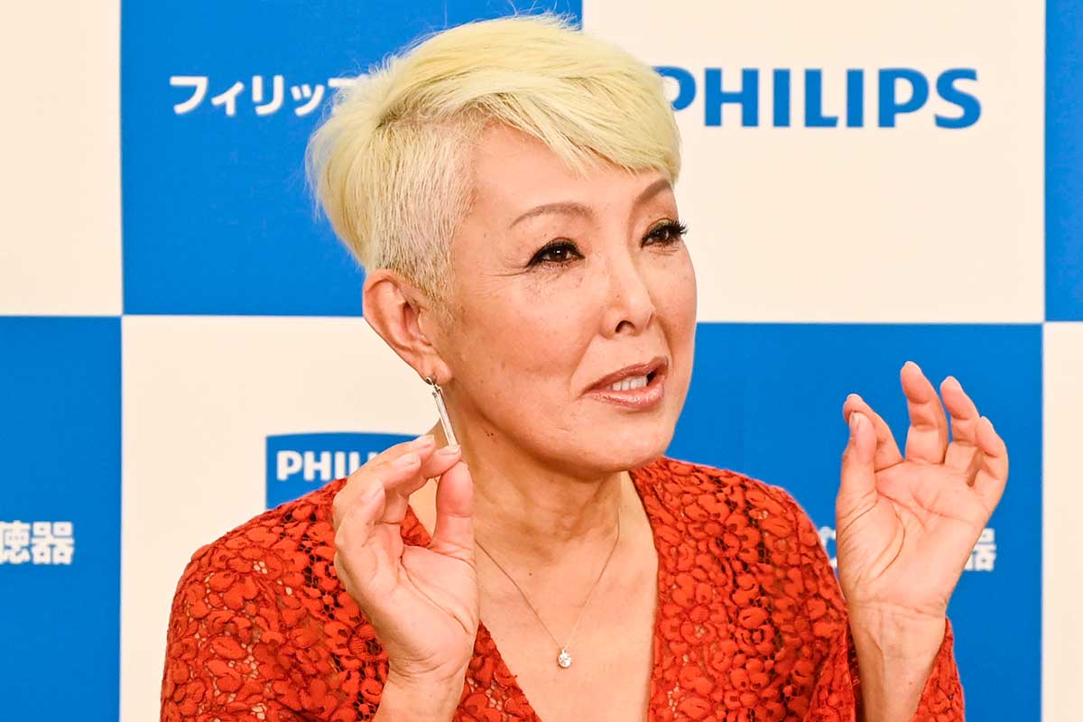 “ピーター”池畑慎之介「車止めにつまづき」怪我　「痛々しい」「大丈夫ですか!?」「危ない！」の声