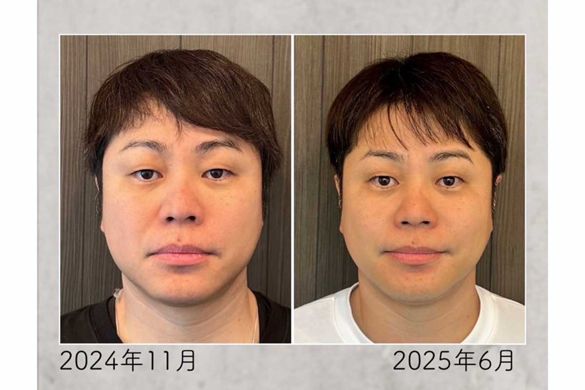 ノンスタ井上、顔の印象が激変　時系列写真に「若返ってる」「凄いスッキリしてる」と反響