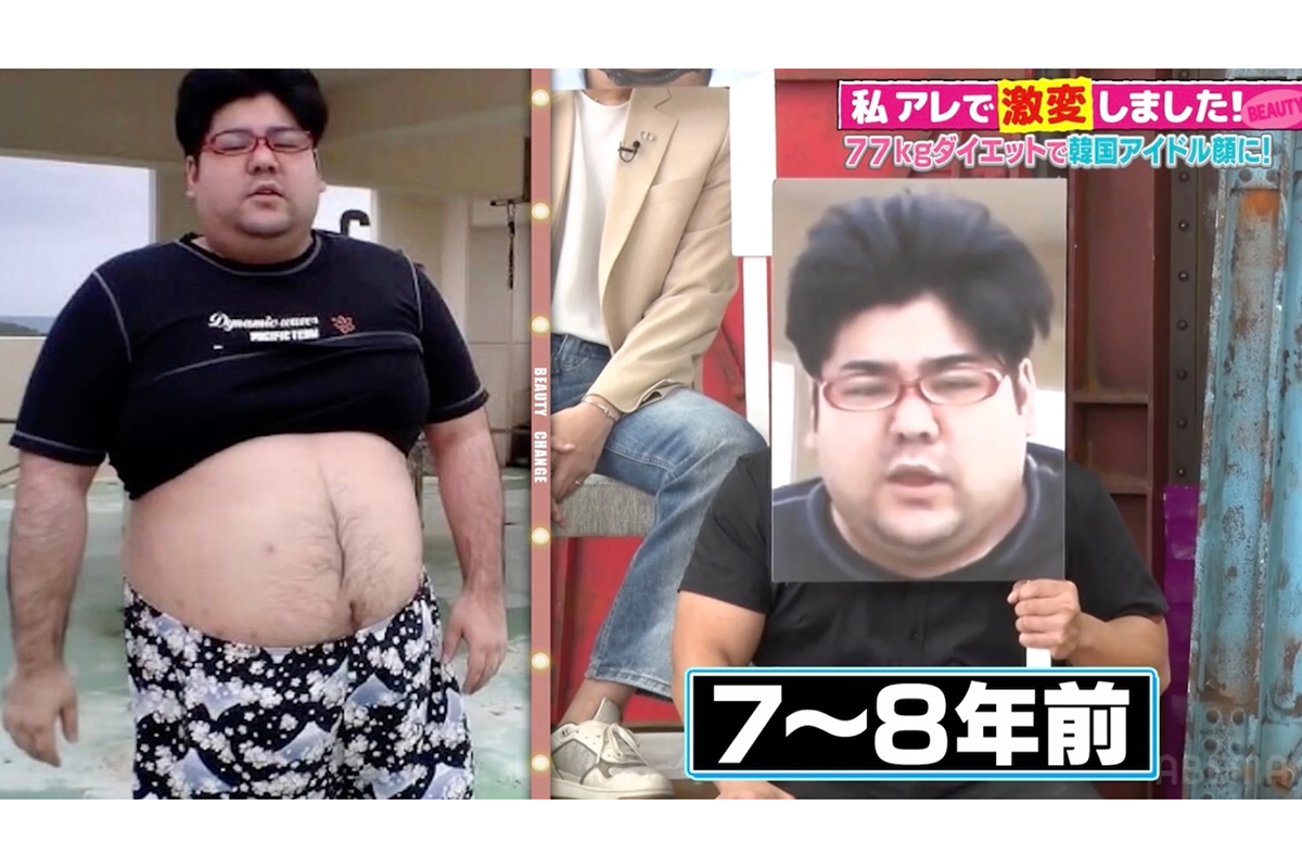 145kg→68kgに“激変”　ダイエットYouTuber、イケメンな現在にスタジオ仰天「違う人だろ！」