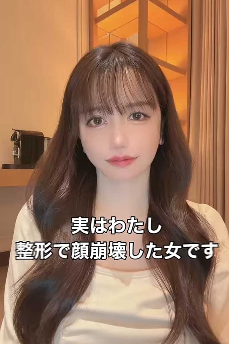 整形YouTuberのらびちゃん【写真：YouTube（@rabichannn）より】