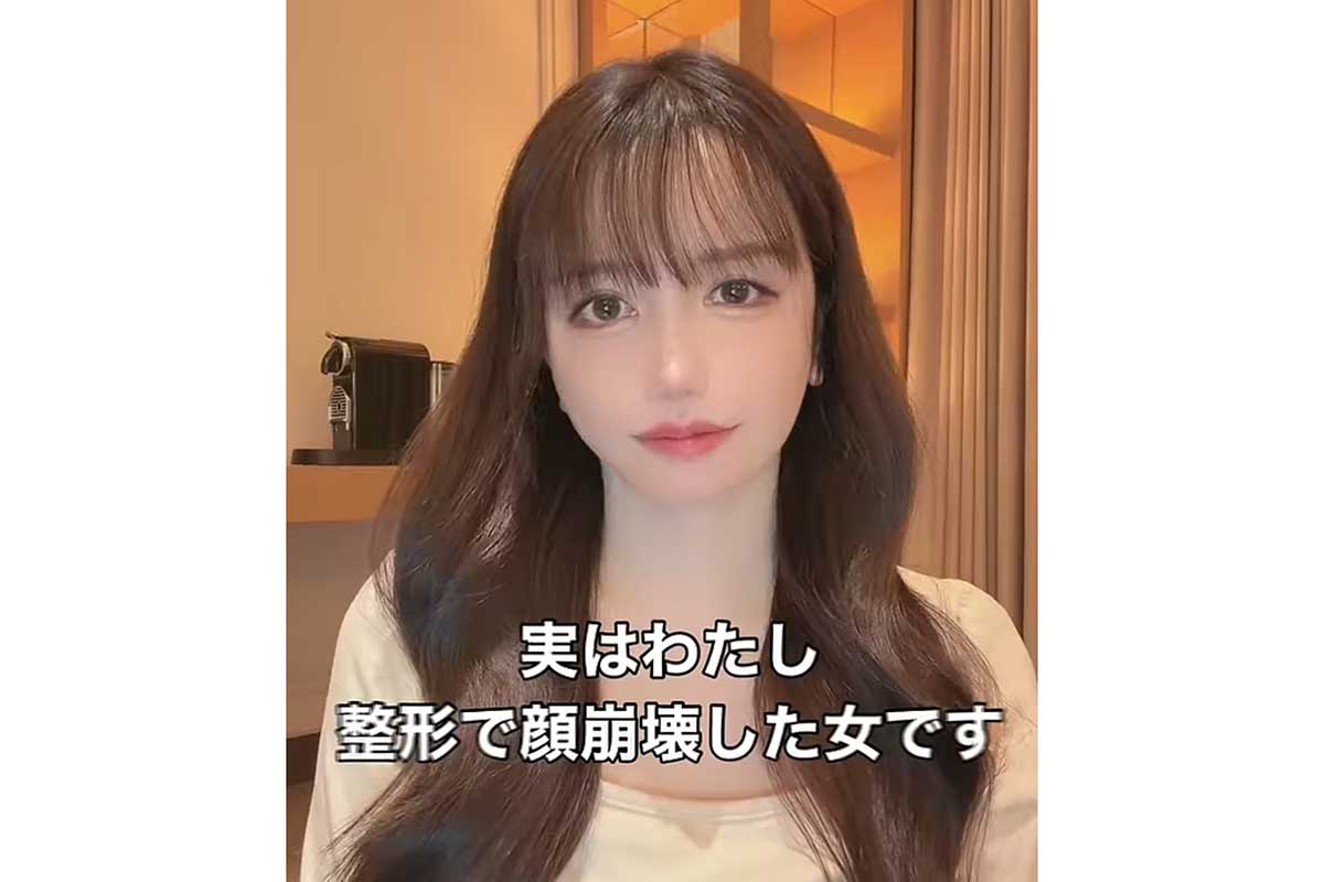 総額5000万円で「顔崩壊」フル整形5周のYouTuberが語る「人生終了しかけた」危機