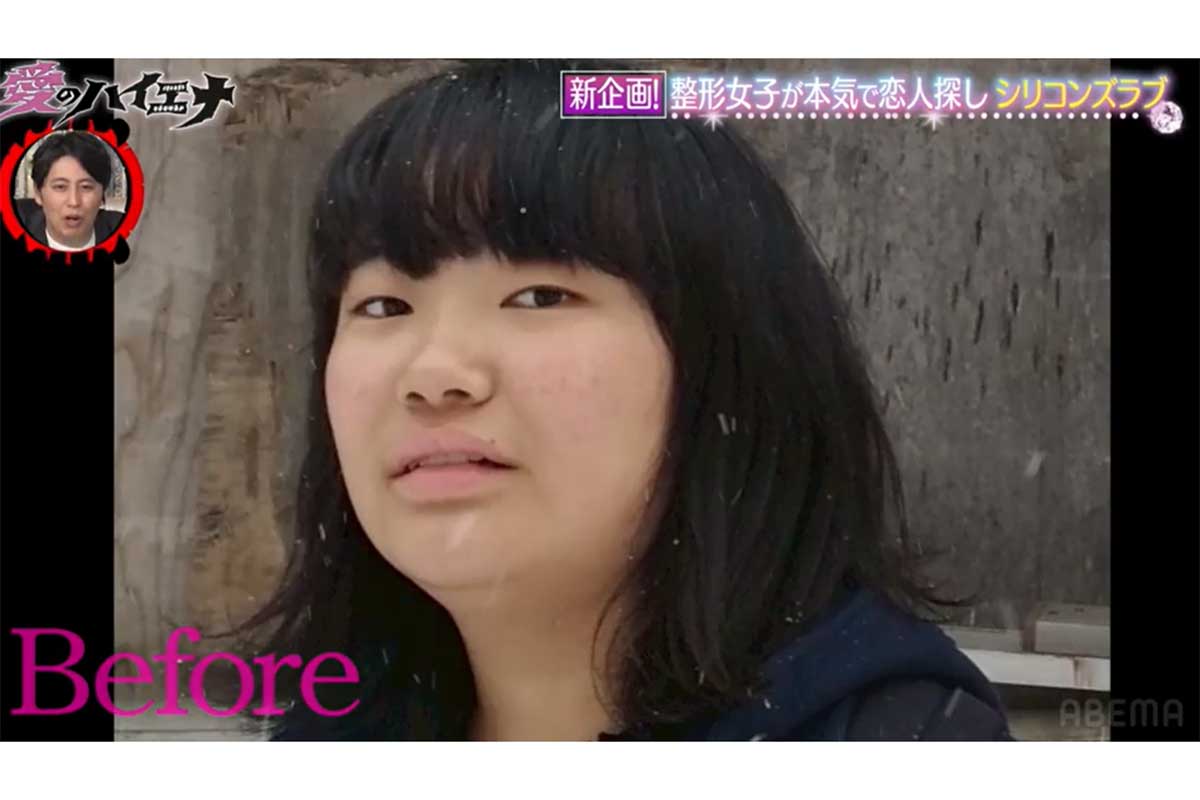 「肋骨を鼻に」「顔切りました」　整形総額2000万円も…女性陣の告白が衝撃的「そんなことできるの？」