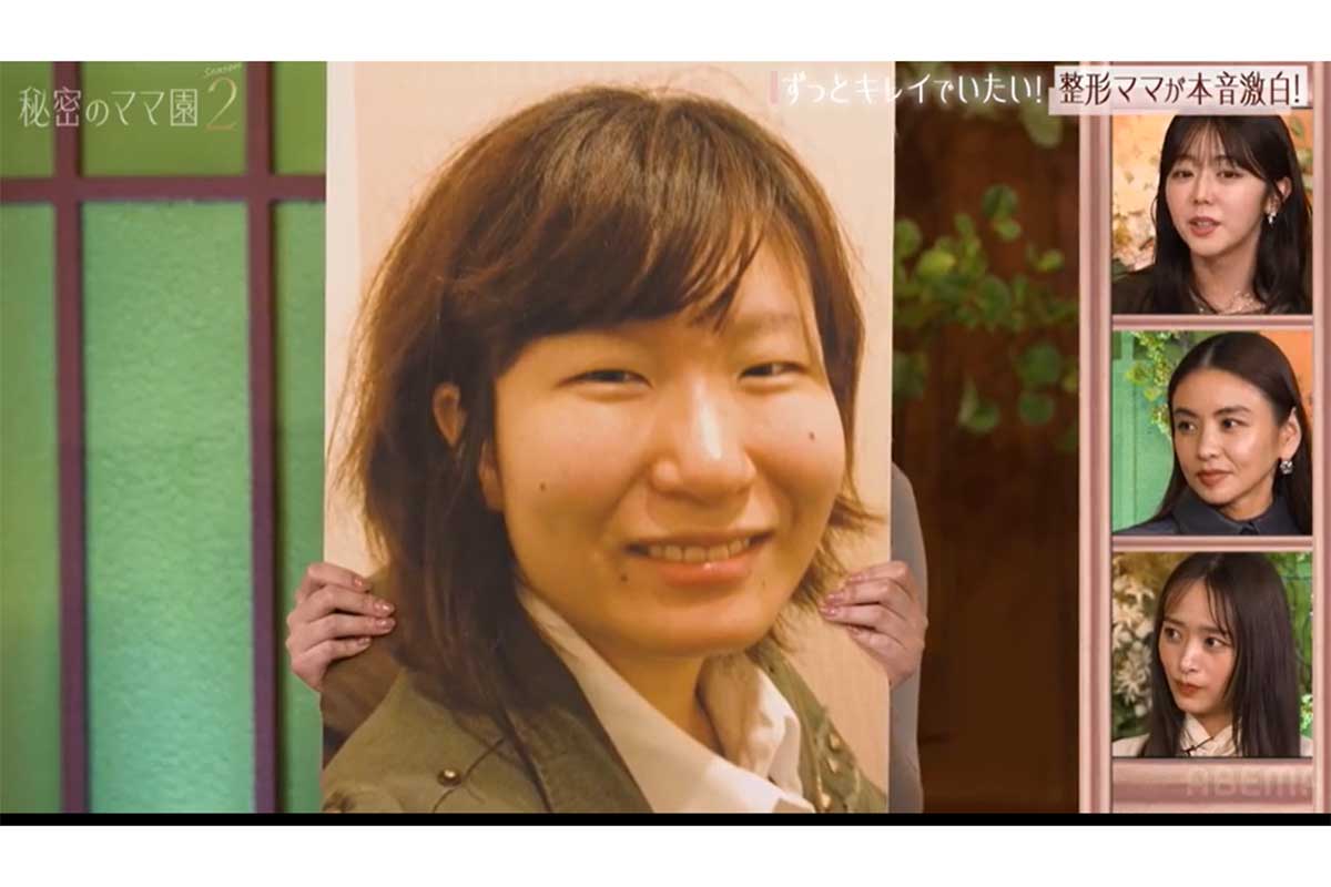 整形総額400万円のビフォーアフターに「えええー！」「ナチュラル」　夫からのキツイひと言で決意