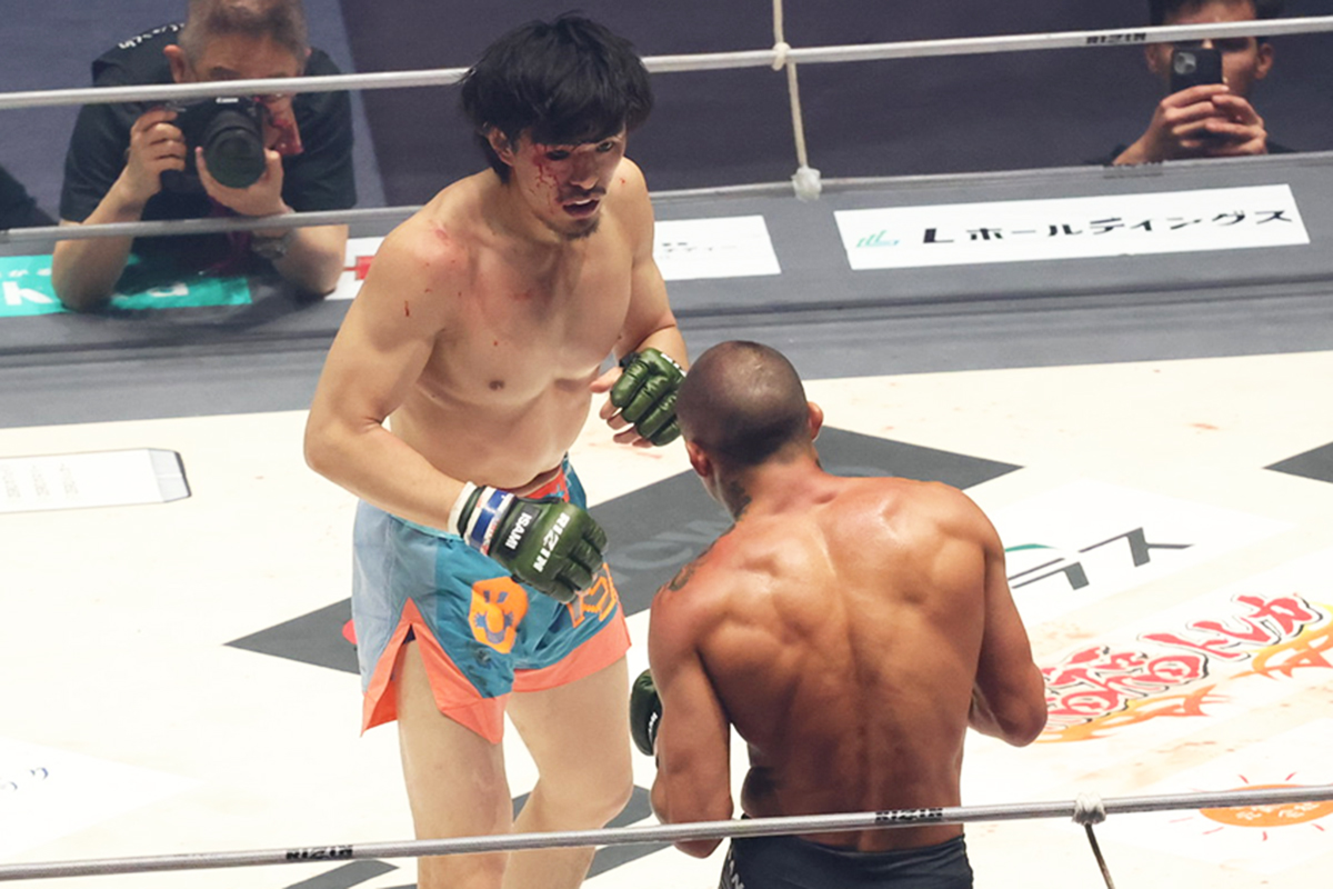 2R・KO負けの桜庭大世、右フック被弾で両顎骨折　口が半開き「痛そうすぎる」「やっぱり」