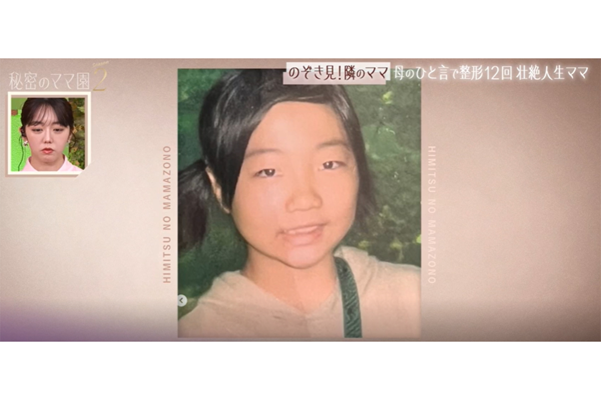 実の母親から「ブス」と罵声→整形12回　運動会でトラウマになった言葉「お前が一番デブ」