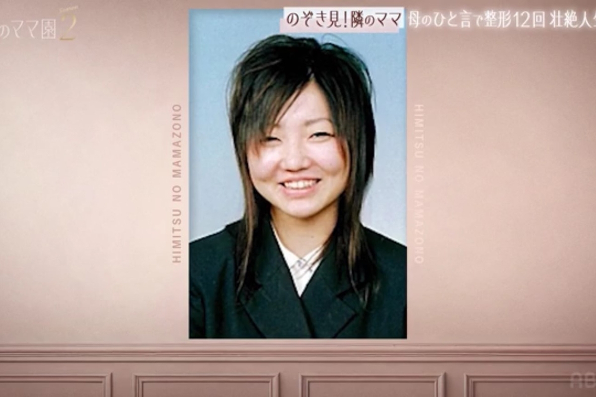 整形回数は12回、34歳2児のママモデル　驚きの総額明かす…変化の推移には「やっぱり変わる～」驚きの声