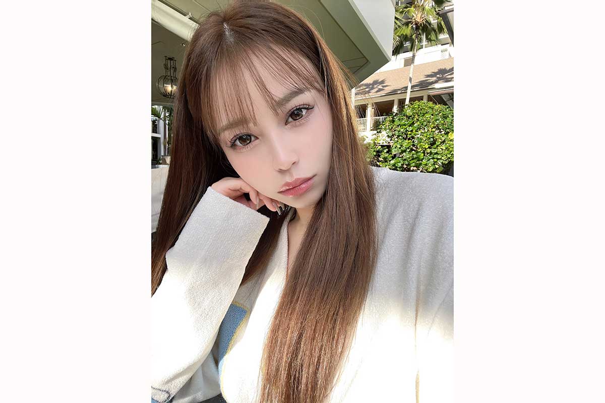 手首に大きな“しこり”「これどうしたらいいの？」　施術後1日で再発…土屋怜菜の報告にファン心配