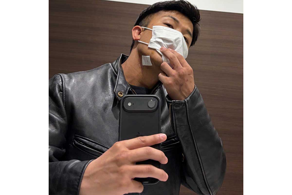 1月に大事故　キックボクサーが首に埋まったガラスを摘出　投稿画像に「怖いですよね」の声