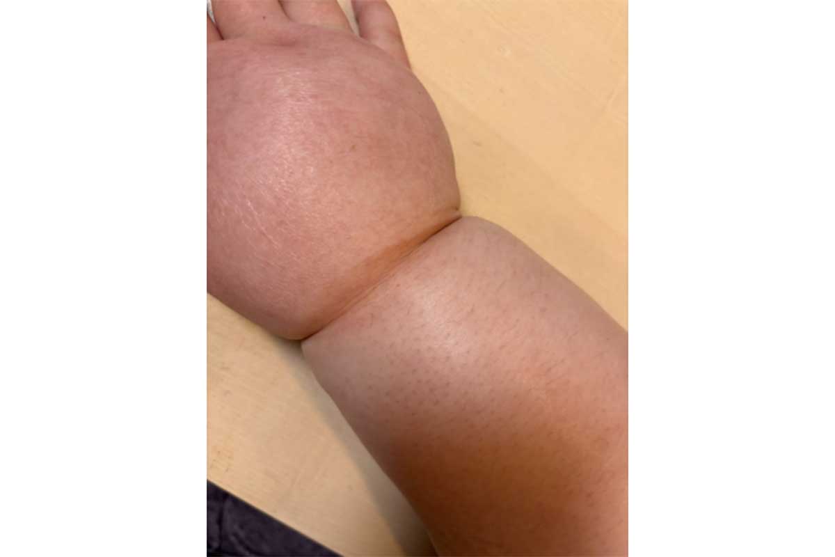 22歳で乳がん宣告、26歳で緩和ケアへ　医療費は年690万円…5歳の息子と作る思い出