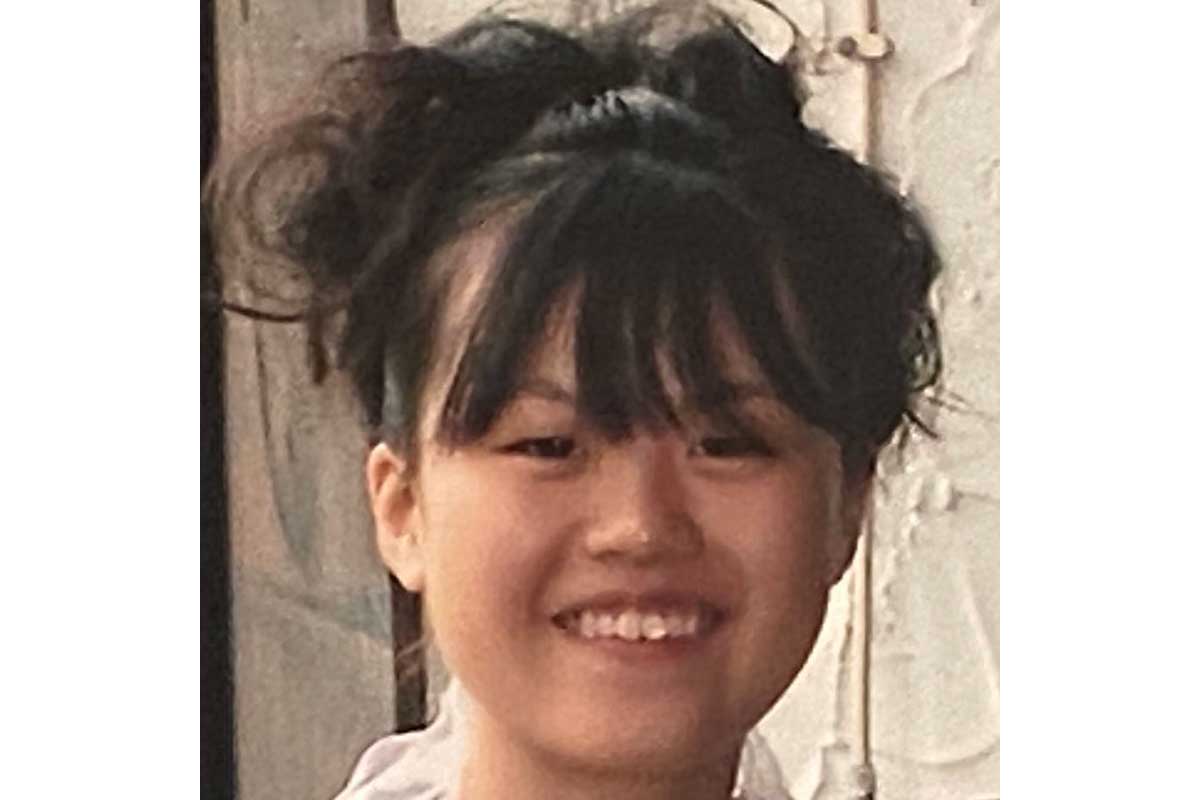 1300万円かけて整形→人生が劇的に変化「何があるかわからん」　ネット「ここまで変わるのすごい」