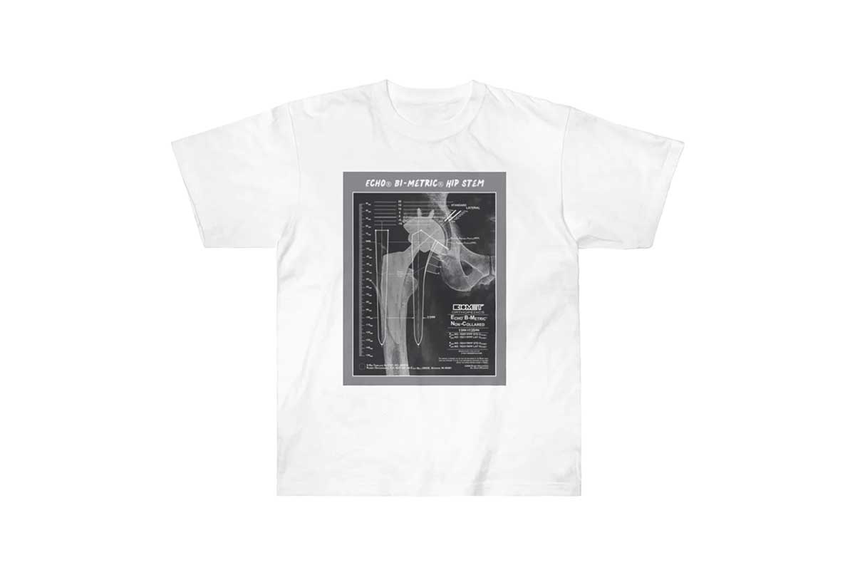 人工股関節が写ったレントゲン写真をTシャツに【写真:本人提供】