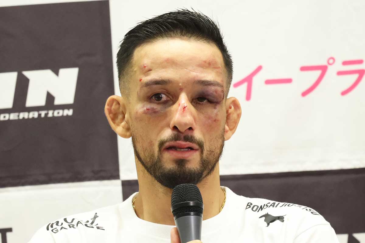【RIZIN】前王者・クレベル、ボコボコ顔面で認めた敗戦「こんな怪我は覚えてない」　明かした敗因「色んな声を受け取りすぎた」